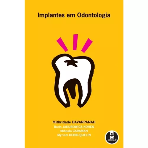 Livro - Implantes Em Odontologia